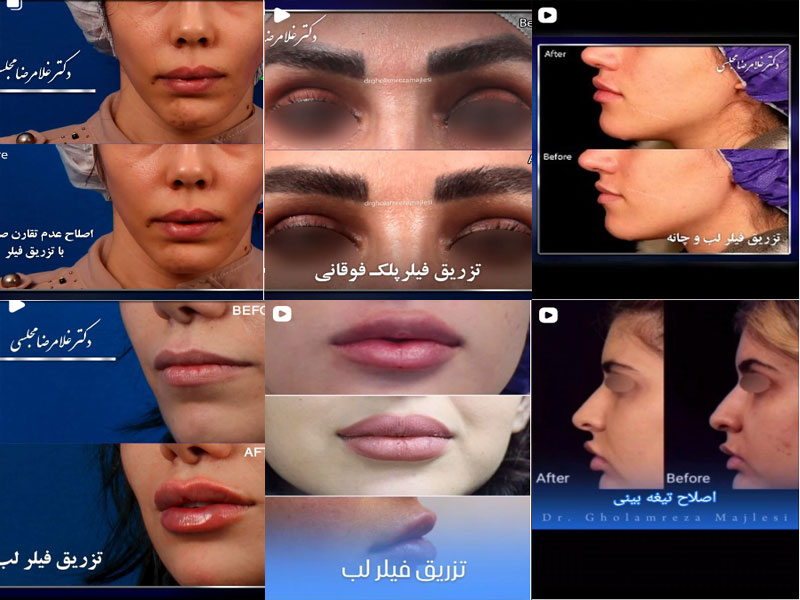 نمونه کار دکتر غلامرضا مجلسی اصفهان