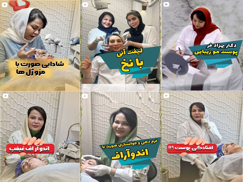 عکس نمونه کار زیبایی دکتر الهه بهزادفر