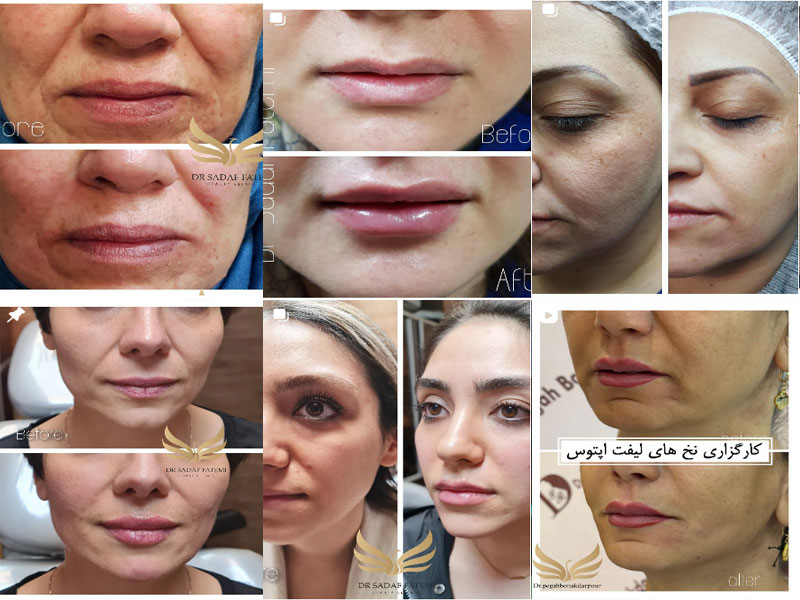 عکس نمونه کار زیبایی دکتر صدف فاطمی