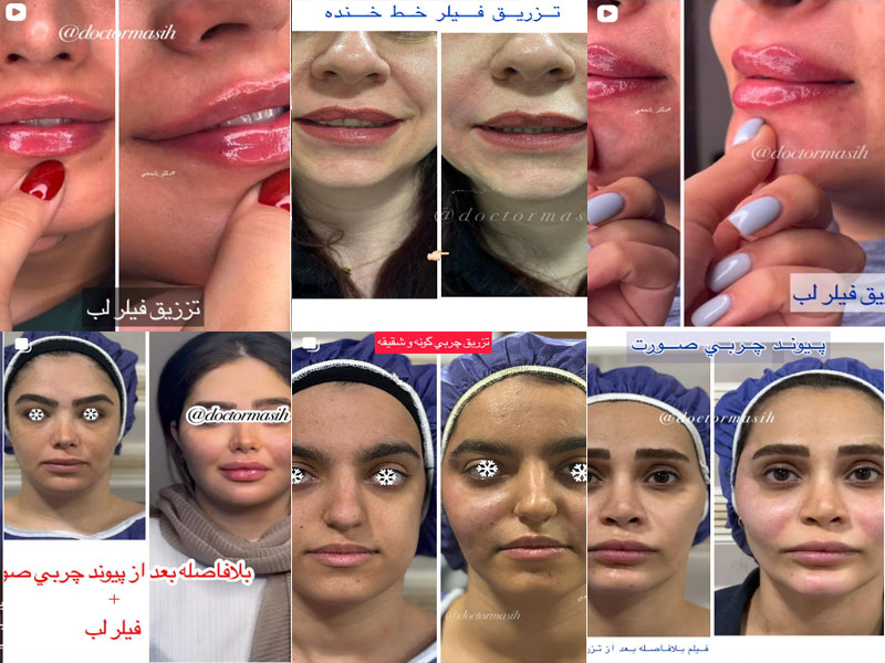 عکس نمونه کار زیبایی دکتر مسیح شمعی