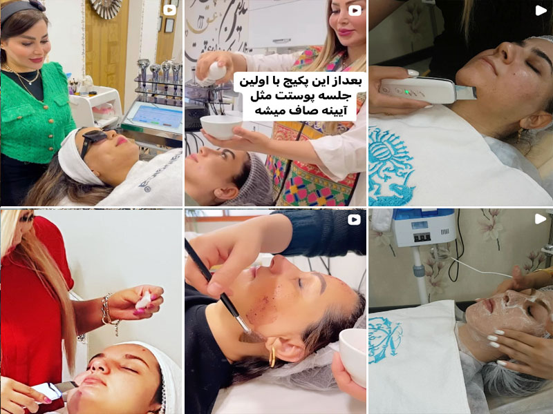 فیشیال صورت نگار رفیعیان اصفهان