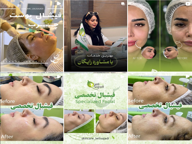 فیشیال صورت اصفهان لیلی سجادی