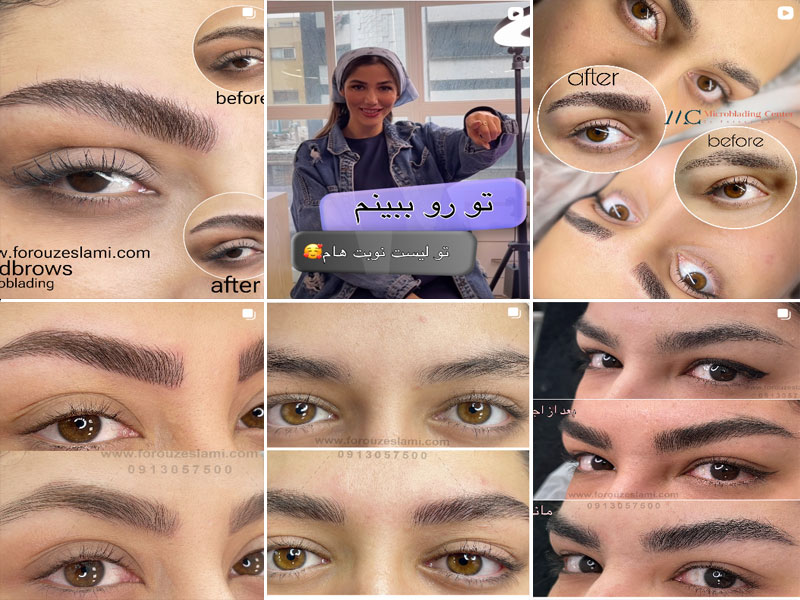 فیبروز ابرو فروز اسلامی اصفهان