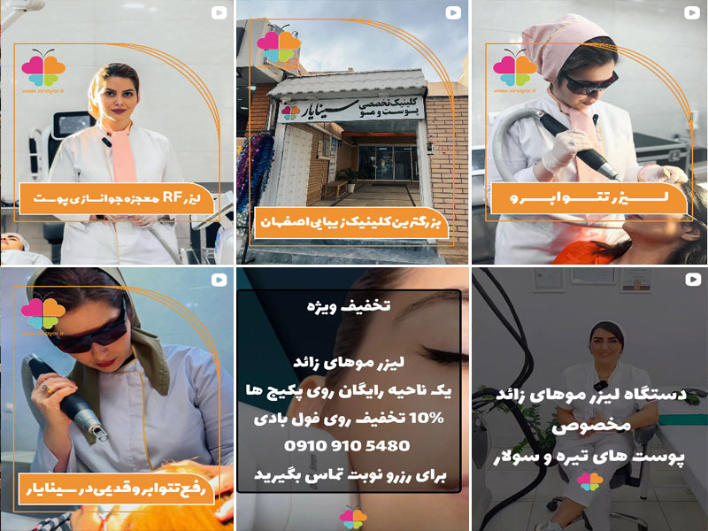 مرکز لیزر موهای زائد سینایار اصفهان