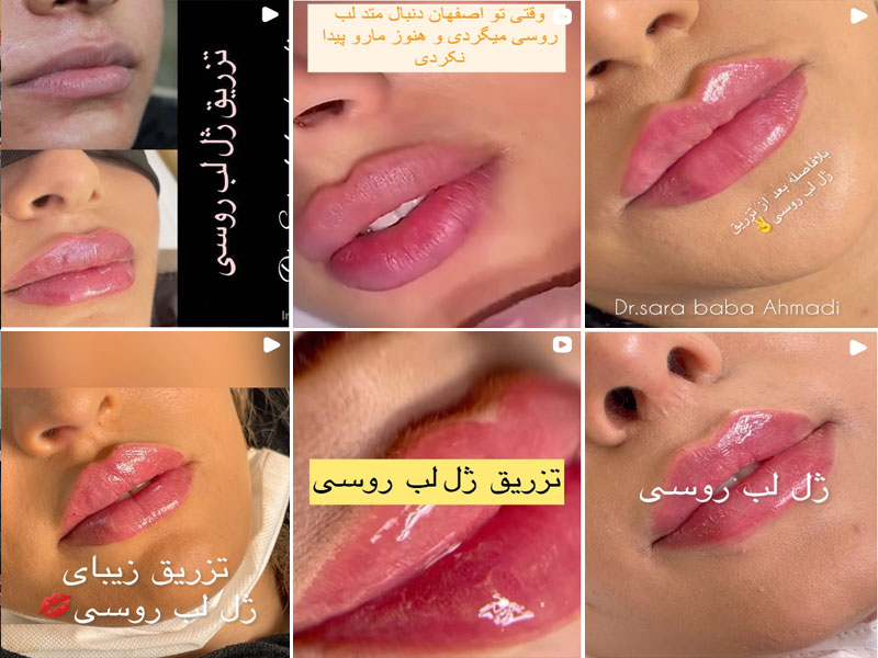 نمونه کار دکتر سارا بابا احمدی اصفهان
