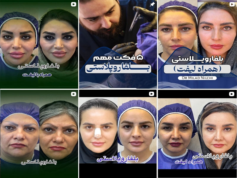 نمونه کار دکتر میلاد نیلچی اصفهان