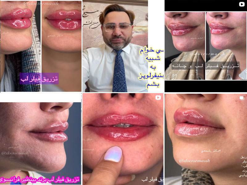 نمونه کارهای دکتر مسیح شمعی اصفهان 
