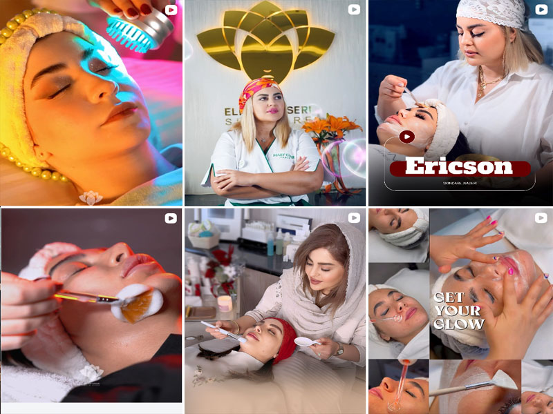 نمونه کار پاکسازی صورت در اصفهان در مرکز تخصصی پاکسازی پوست الهام ناصری اصفهان 