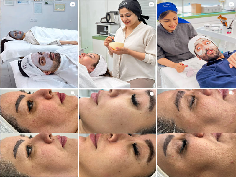 نمونه کار پاکسازی پوست در مرکز خدمات پوست آزاده گوهرآرا اصفهان 