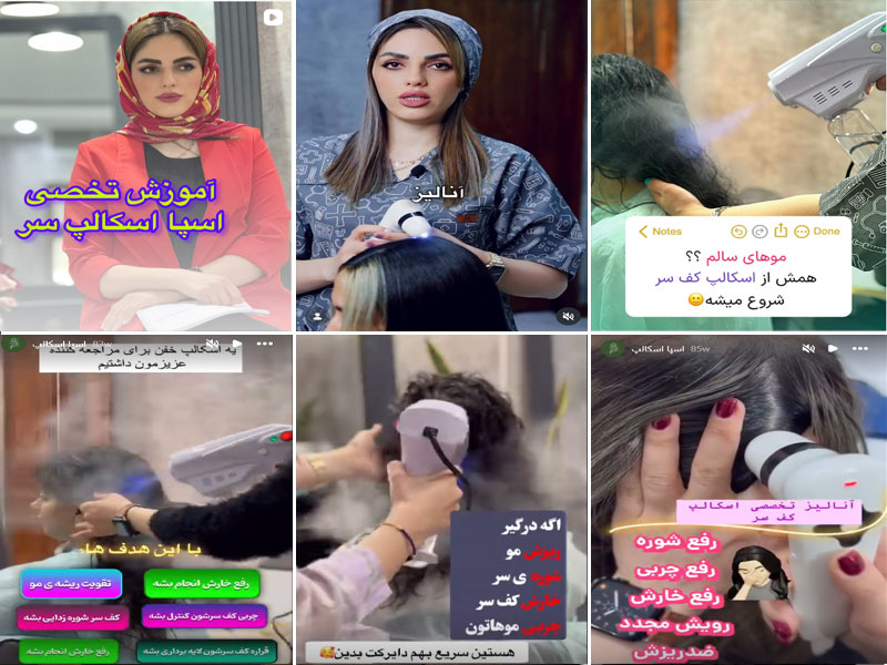 عکس های اسکراب اسکالپ کف سر توسط  نیلوفر فرهمند