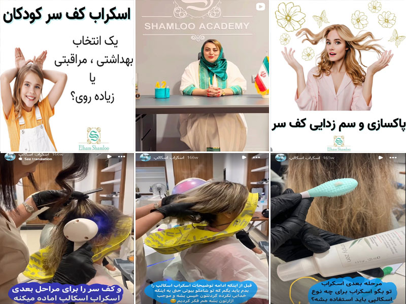 عکس آنالیز پوست سر و اسکالپ اسکراب سر توسط شاملو بیوتی
