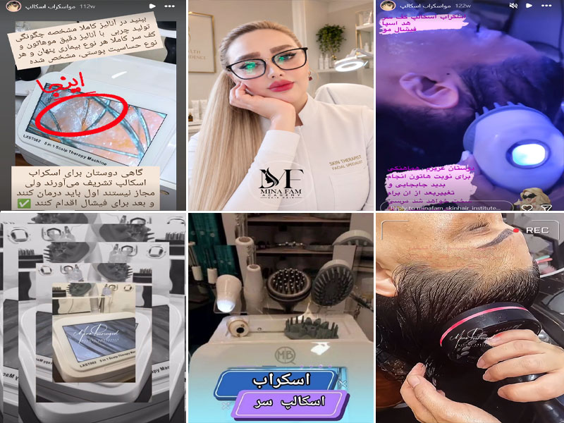 عکس اسکراب اسکالپ کف سر با مینا فام