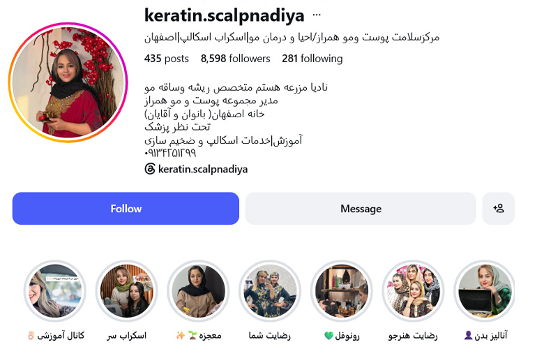 آموزش اسکراب اسکالپ سر نادیا مزرعه
