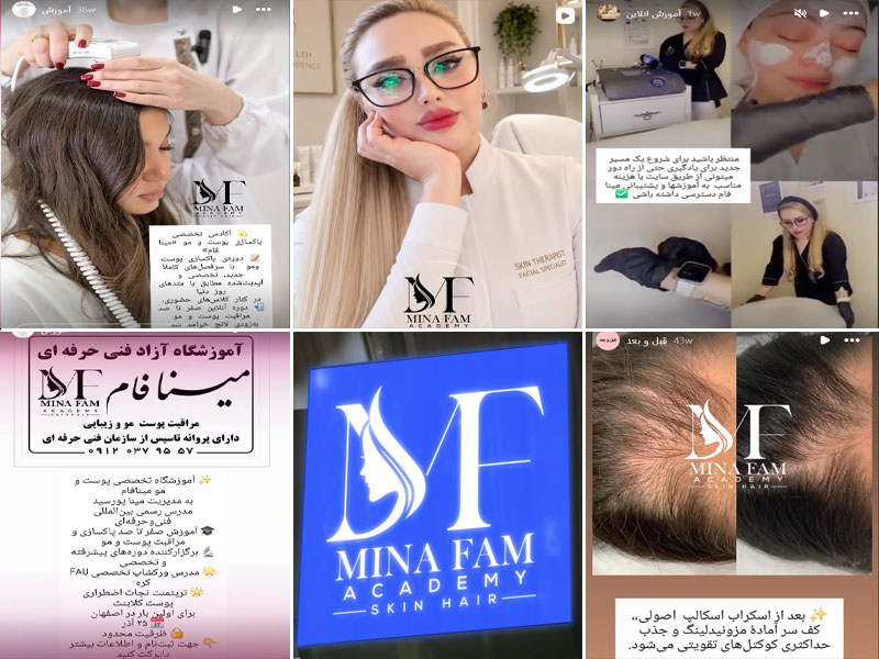 عکس آکادمی اسکراب اسکالپ مینا فام