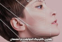 اندولیفت در اصفهان
