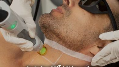 بهترین مرکز لیزر آقایان در اصفهان