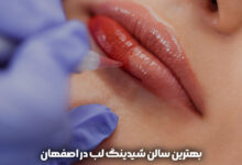 شیدینگ لب در اصفهان
