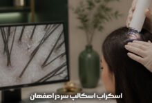 اسکراب اسکالپ سر در اصفهان